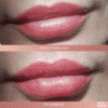 powiększanie ust Juvederm VOLIFT katowice