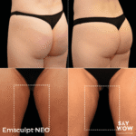 Emsculpt NEO - Say WOW Clinic
