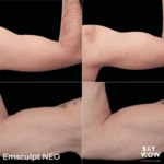 Emsculpt NEO - Say WOW Clinic