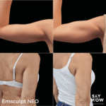 Emsculpt NEO - Say WOW Clinic