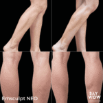 Emsculpt NEO - Say WOW Clinic
